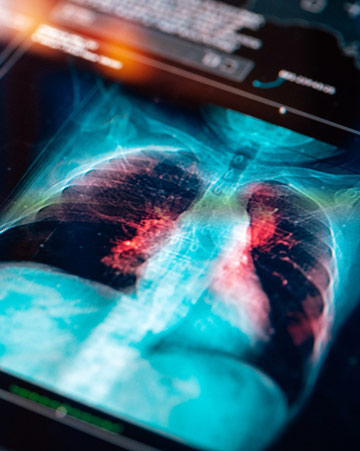 Medical MRI Scan on digital screen