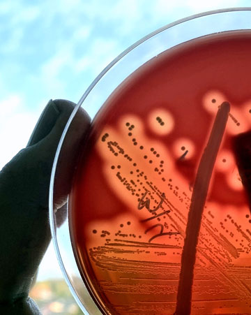 Close-up of streptococcus pyogenes Petri dish being held