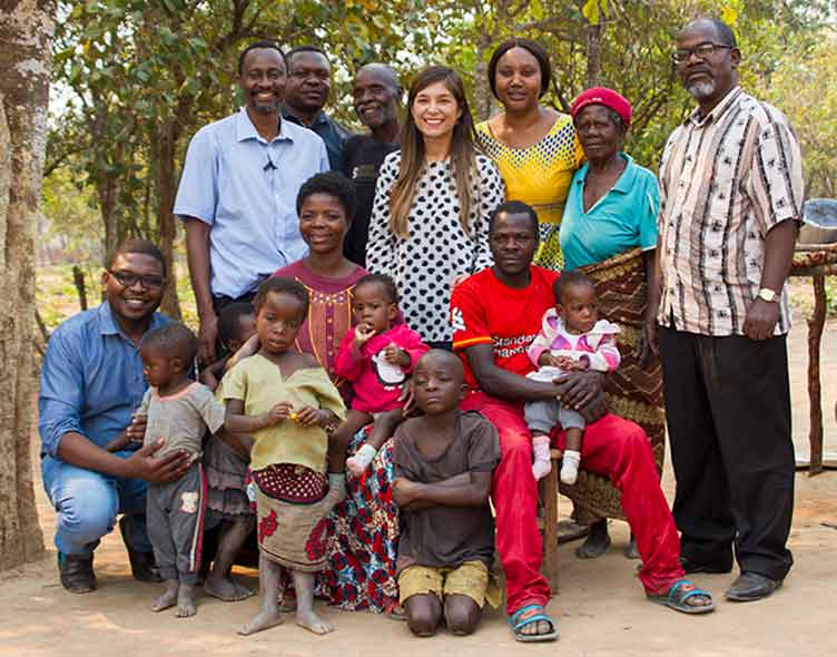 Conjoined twins in Zambia