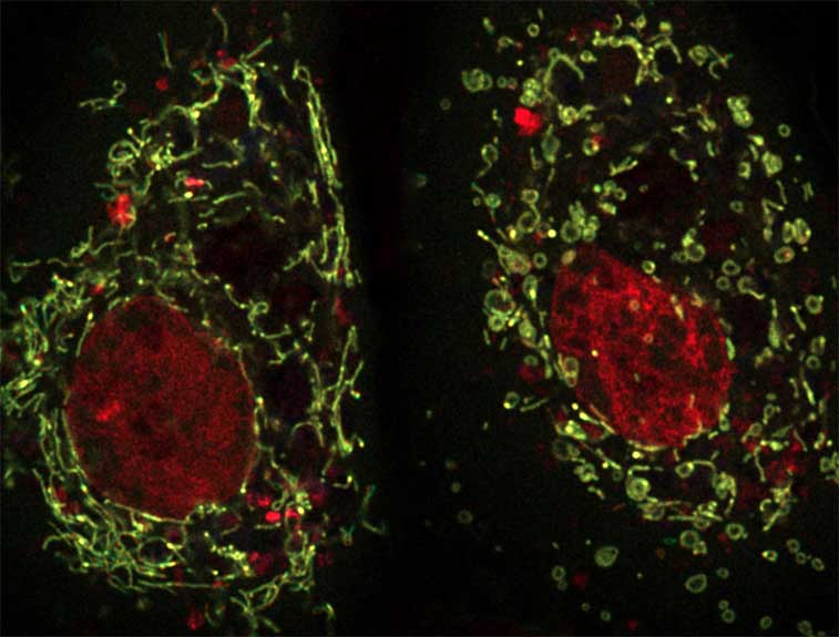 Cell imaging