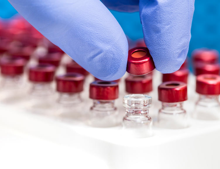 Close-up of blood sample medical tubes