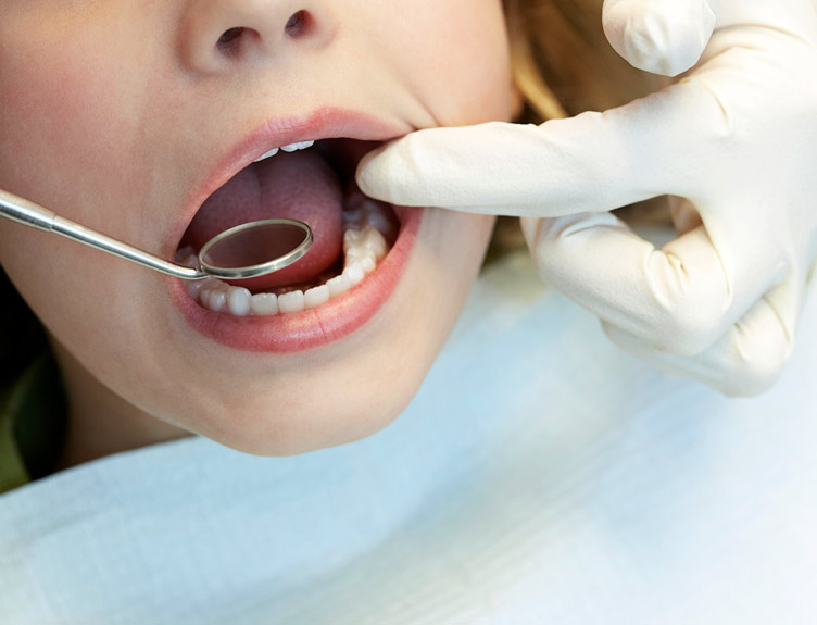 Dental procedure