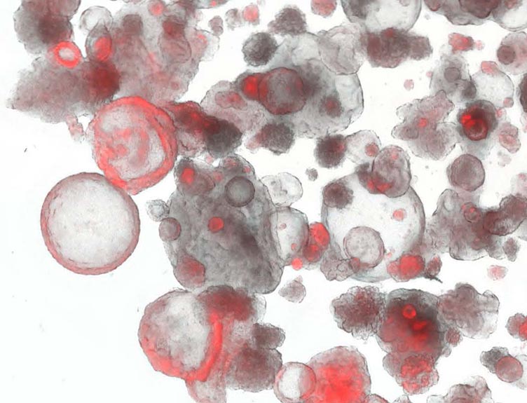 Lung Organoids