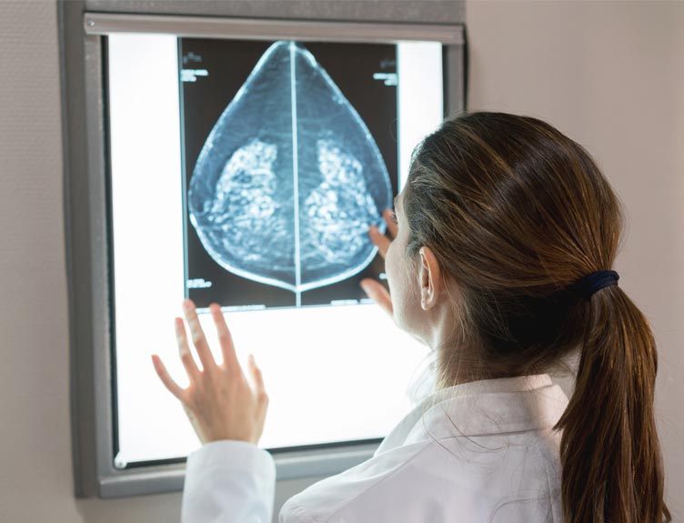 Mammogram