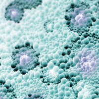 RALA FKBPL - Tackling obesity with a new nanomedicine
