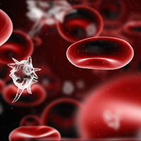 sepsis