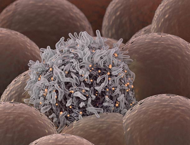 Cancer research