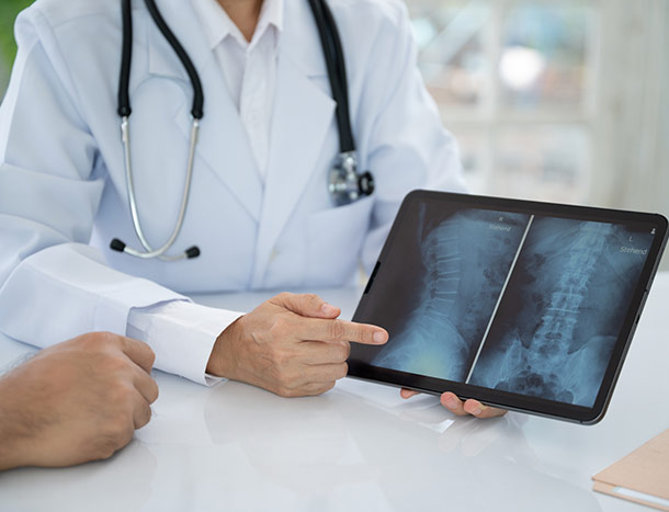 Doctor, in white coat, shows patient Xray of spine.