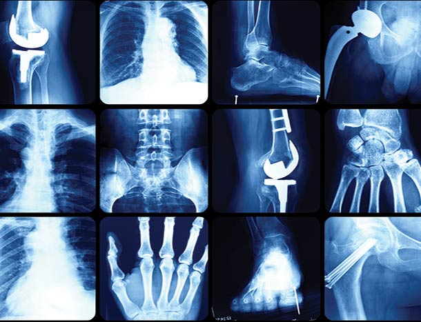 Regenerative medicine research