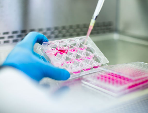 Close up of clinical microbiology trial