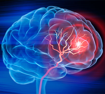 A scan of the brain showing the nervous system.