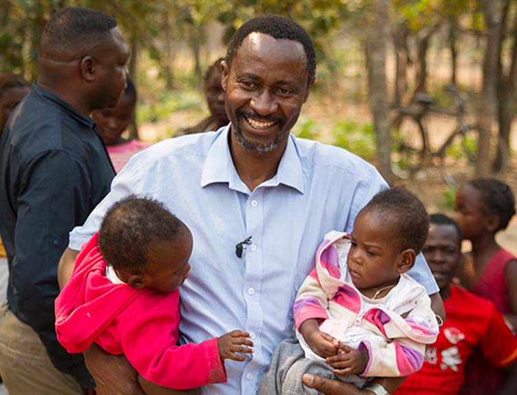 Separating conjoined twins in Zambia